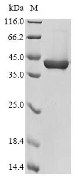(Tris-Glycine gel) Discontinuous SDS-PAGE (reduced) with 5% enrichment gel and 15% separation gel.