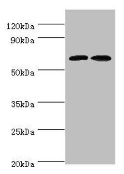 Western blot. All lanes: CREB3L2 antibody at 6ug/ml. Lane 1: Mouse liver tissue. Lane 2: Mouse lung tissue. Secondary. Goat polyclonal to rabbit IgG at 1/10000 dilution. Predicted band size: 58, 51, 28 kDa. Observed band size: 58 kDa. 