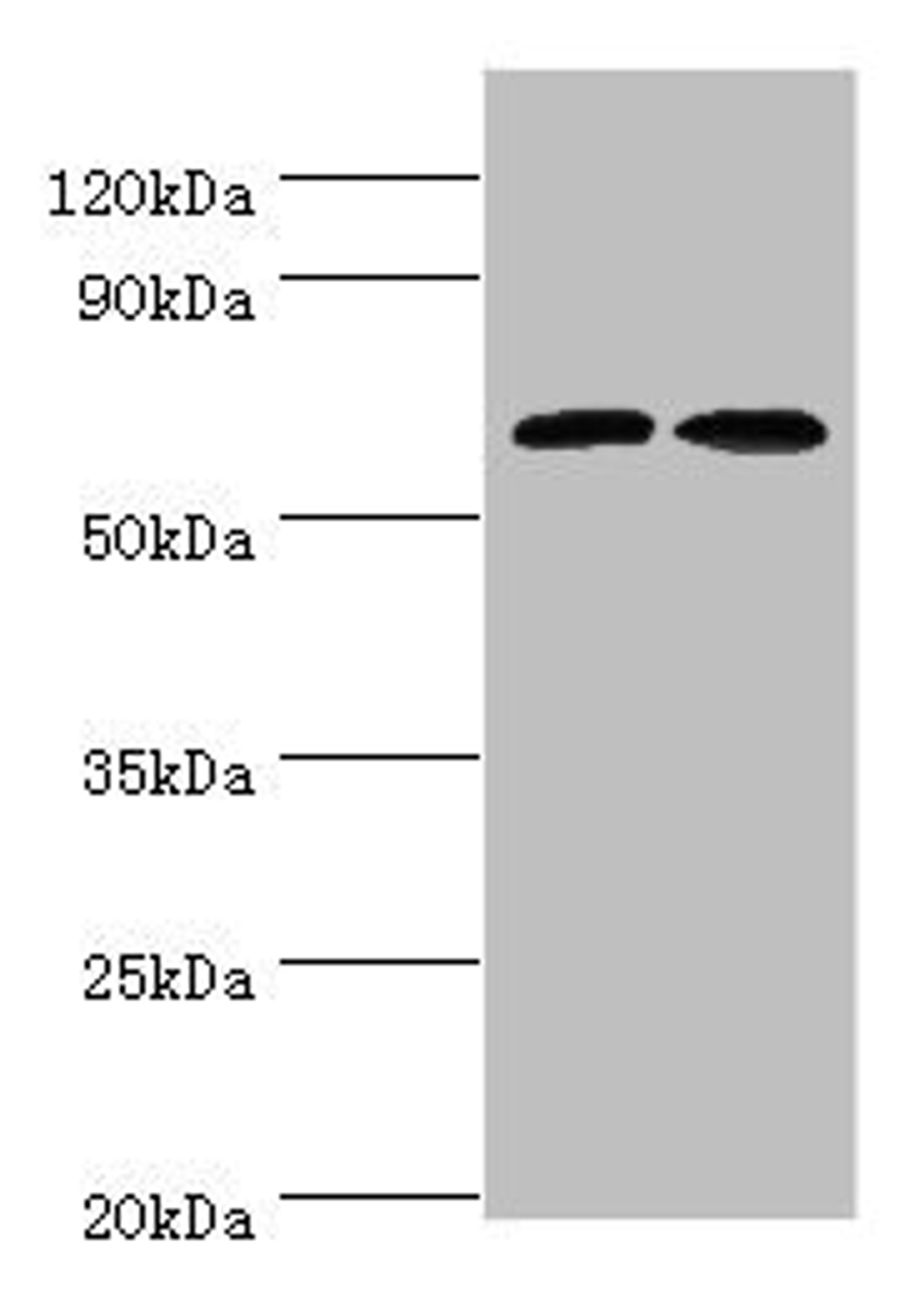 Western blot. All lanes: CREB3L2 antibody at 6ug/ml. Lane 1: Mouse liver tissue. Lane 2: Mouse lung tissue. Secondary. Goat polyclonal to rabbit IgG at 1/10000 dilution. Predicted band size: 58, 51, 28 kDa. Observed band size: 58 kDa. 
