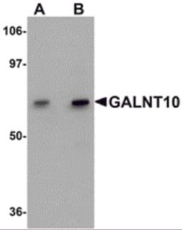 Western blot analysis of GALNT10 in SK-N-SH cell lysate with GALNT10 antibody at (A) 1 and (B) 2 μg/mL.