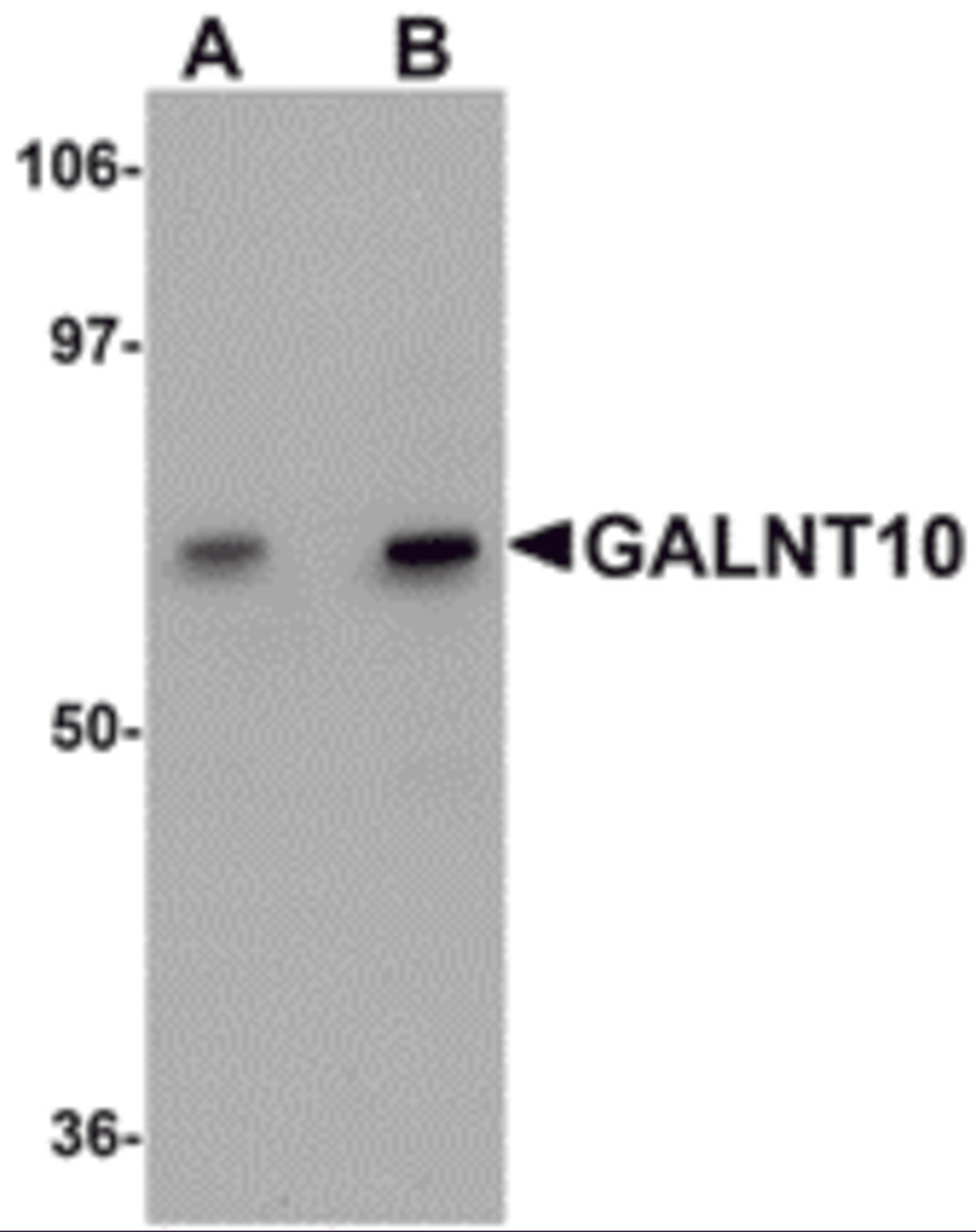 Western blot analysis of GALNT10 in SK-N-SH cell lysate with GALNT10 antibody at (A) 1 and (B) 2 μg/mL.