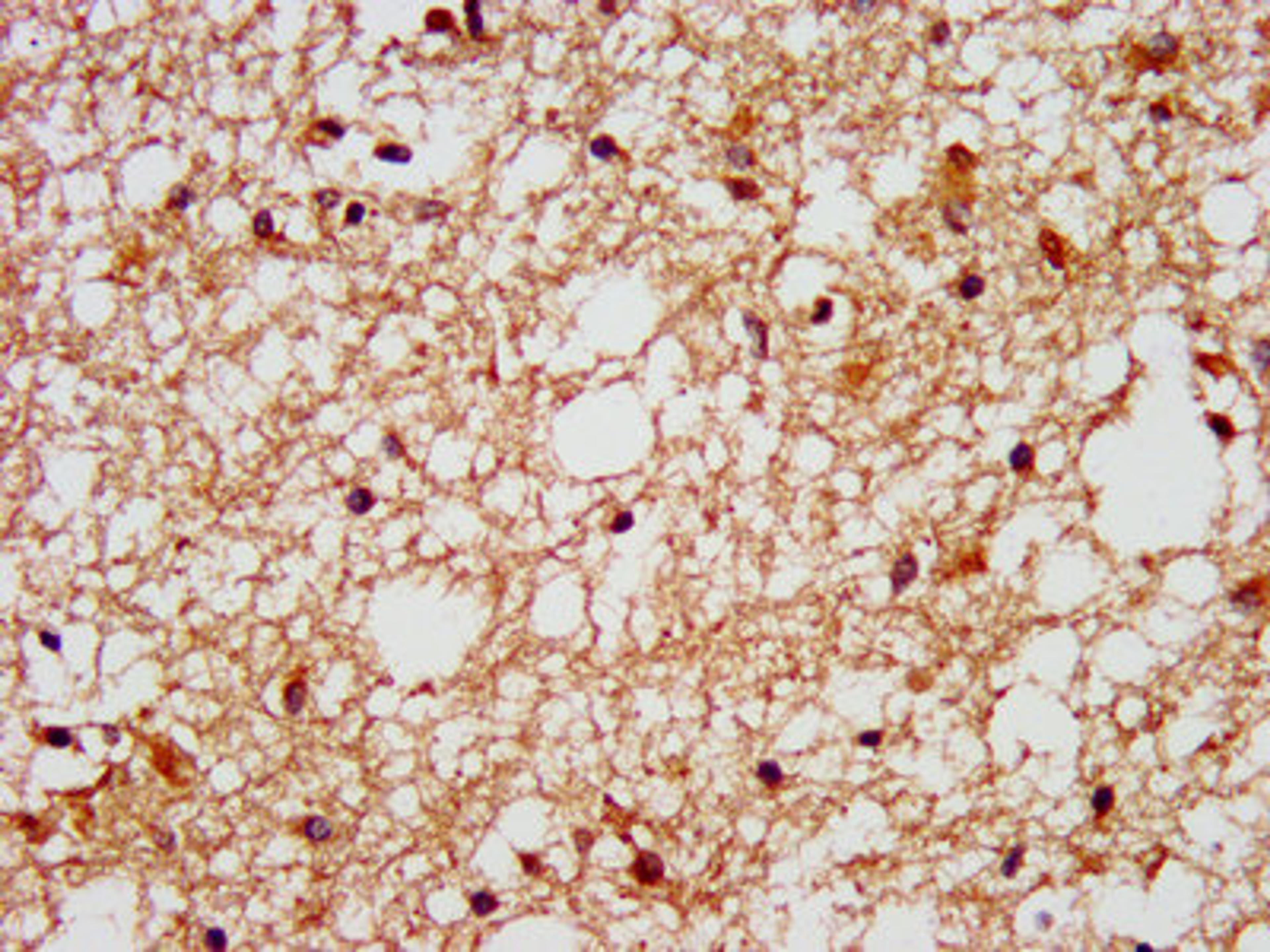 IHC image of CSB-PA008604LA01HU diluted at 1:400 and staining in paraffin-embedded human brain tissue performed on a Leica BondTM system. After dewaxing and hydration, antigen retrieval was mediated by high pressure in a citrate buffer (pH 6.0). Section was blocked with 10% normal goat serum 30min at RT. Then primary antibody (1% BSA) was incubated at 4°C overnight. The primary is detected by a biotinylated secondary antibody and visualized using an HRP conjugated SP system.