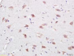 Immunohistochemical staining of rat brain tissue using C1orf173 antibody.