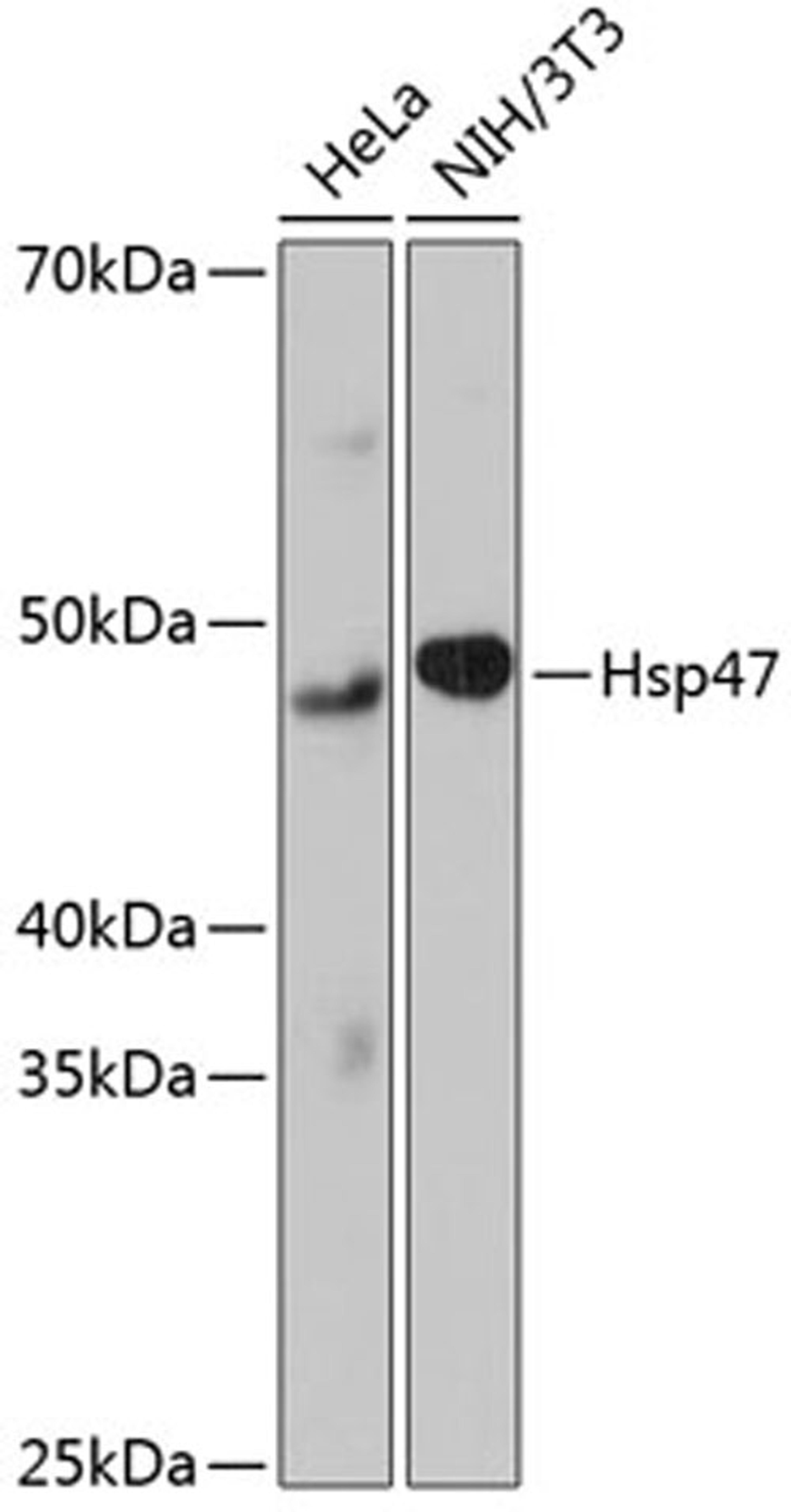 Western blot - Hsp47 Rabbit mAb (A11698)