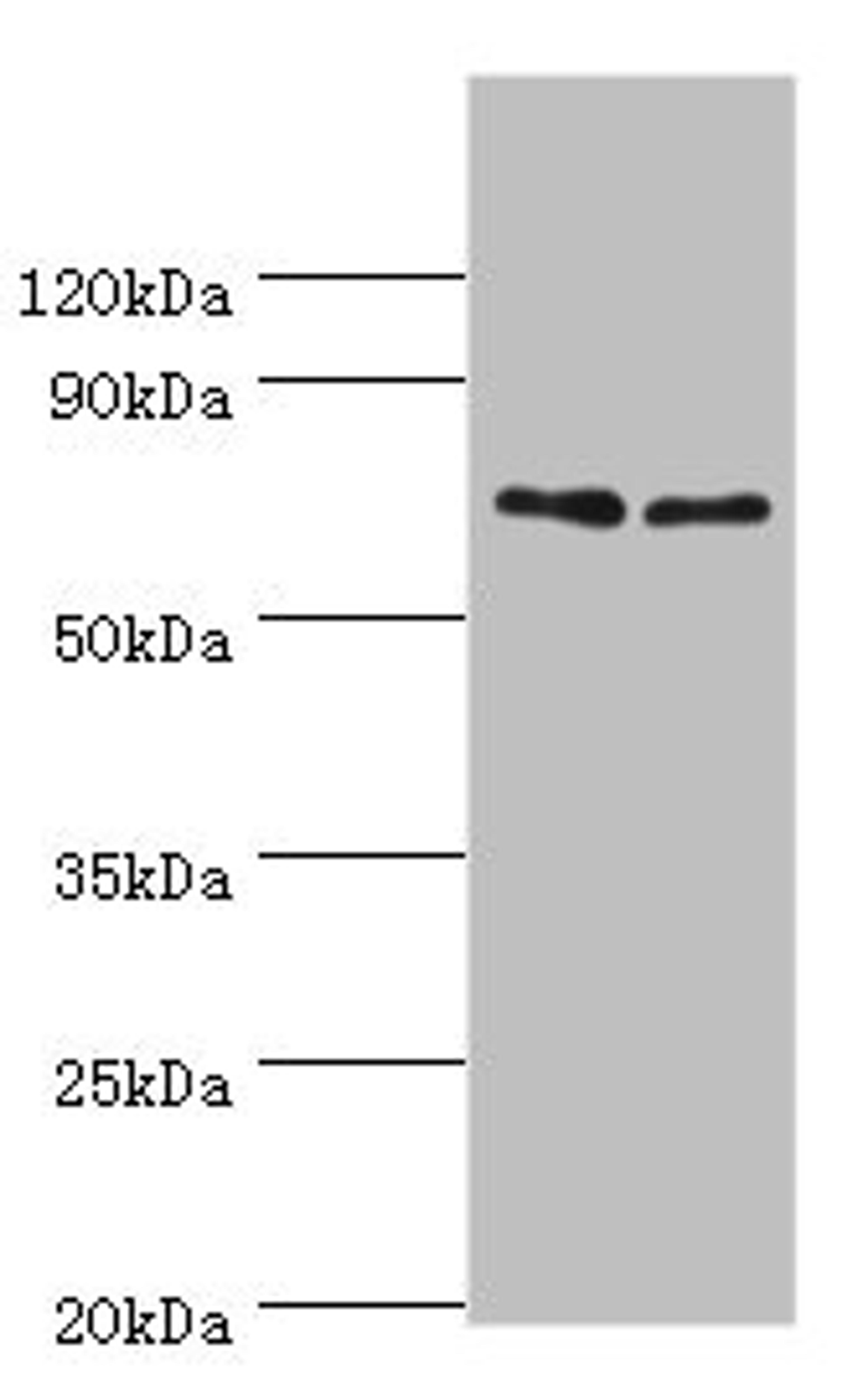 Western blot. All lanes: TNFRSF21 antibody at 4ug/ml. Lane 1: K562 whole cell lysate. Lane 2: Jurkat whole cell lysate. Secondary. Goat polyclonal to rabbit IgG at 1/10000 dilution. Predicted band size: 72 kDa. Observed band size: 72 kDa. 