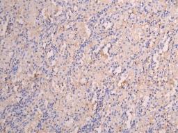 IHC image of CSB-RA008545MA1HU diluted at 1:150 and staining in paraffin-embedded human lung tissue performed on a Leica BondTM system. After dewaxing and hydration, antigen retrieval was mediated by high pressure in a citrate buffer (pH 6.0). Section was blocked with 10% normal goat serum 30min at RT. Then primary antibody (1% BSA) was incubated at 4°C overnight. The primary is detected by a Goat anti-human polymer IgG labeled by HRP and visualized using 0.05% DAB.