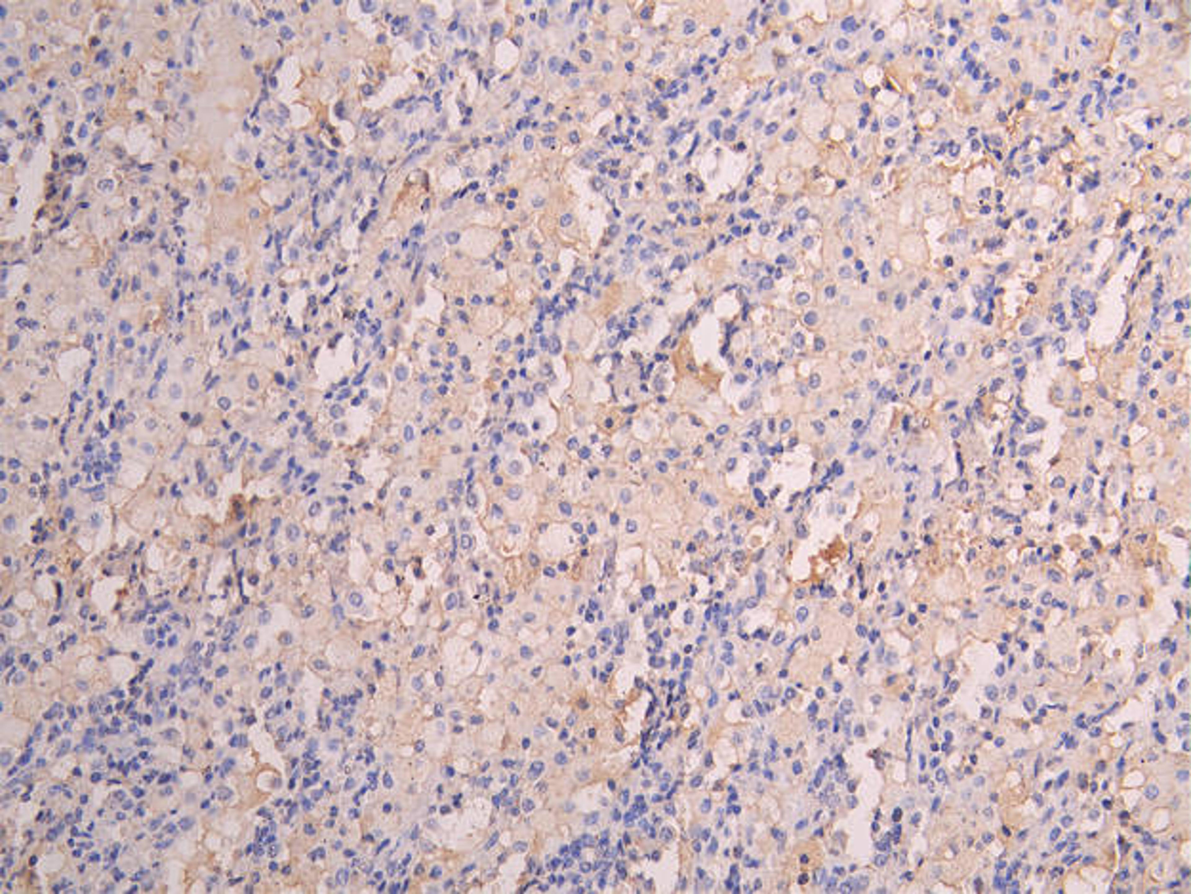 IHC image of CSB-RA008545MA1HU diluted at 1:150 and staining in paraffin-embedded human lung tissue performed on a Leica BondTM system. After dewaxing and hydration, antigen retrieval was mediated by high pressure in a citrate buffer (pH 6.0). Section was blocked with 10% normal goat serum 30min at RT. Then primary antibody (1% BSA) was incubated at 4°C overnight. The primary is detected by a Goat anti-human polymer IgG labeled by HRP and visualized using 0.05% DAB.
