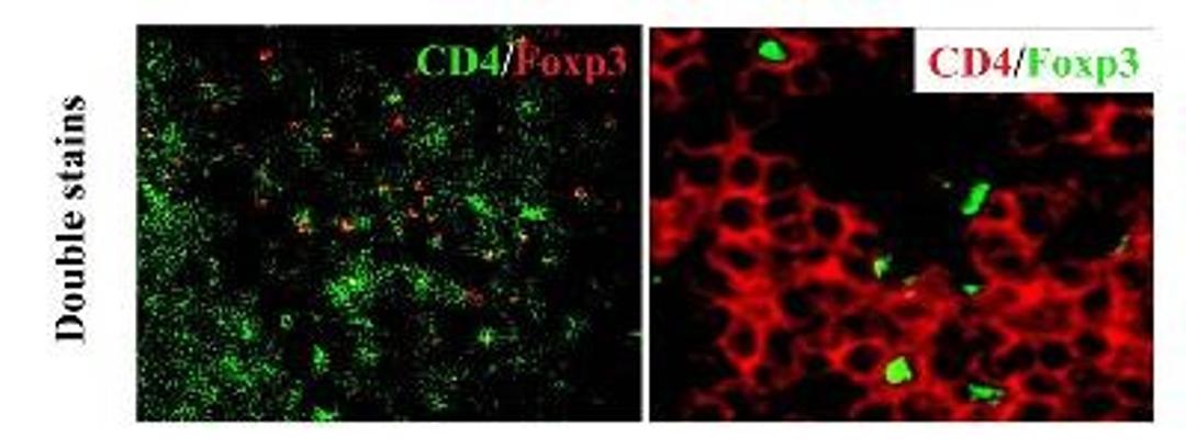 Immunocytochemistry/Immunofluorescence: FOXP3 Antibody [NB600-245] - Sample: Healthy thymus from a C57BL/6 mouse