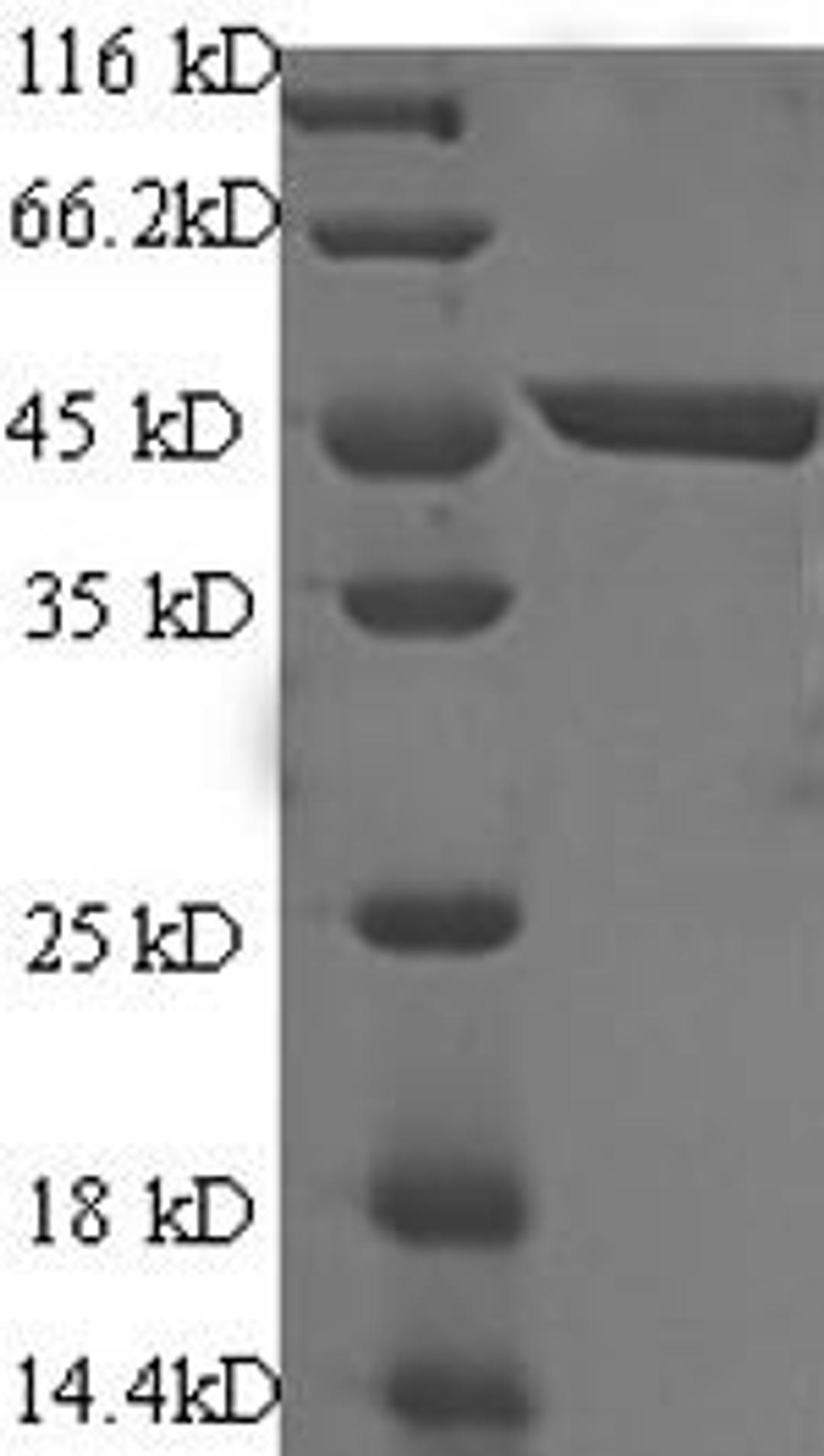 (Tris-Glycine gel) Discontinuous SDS-PAGE (reduced) with 5% enrichment gel and 15% separation gel.
