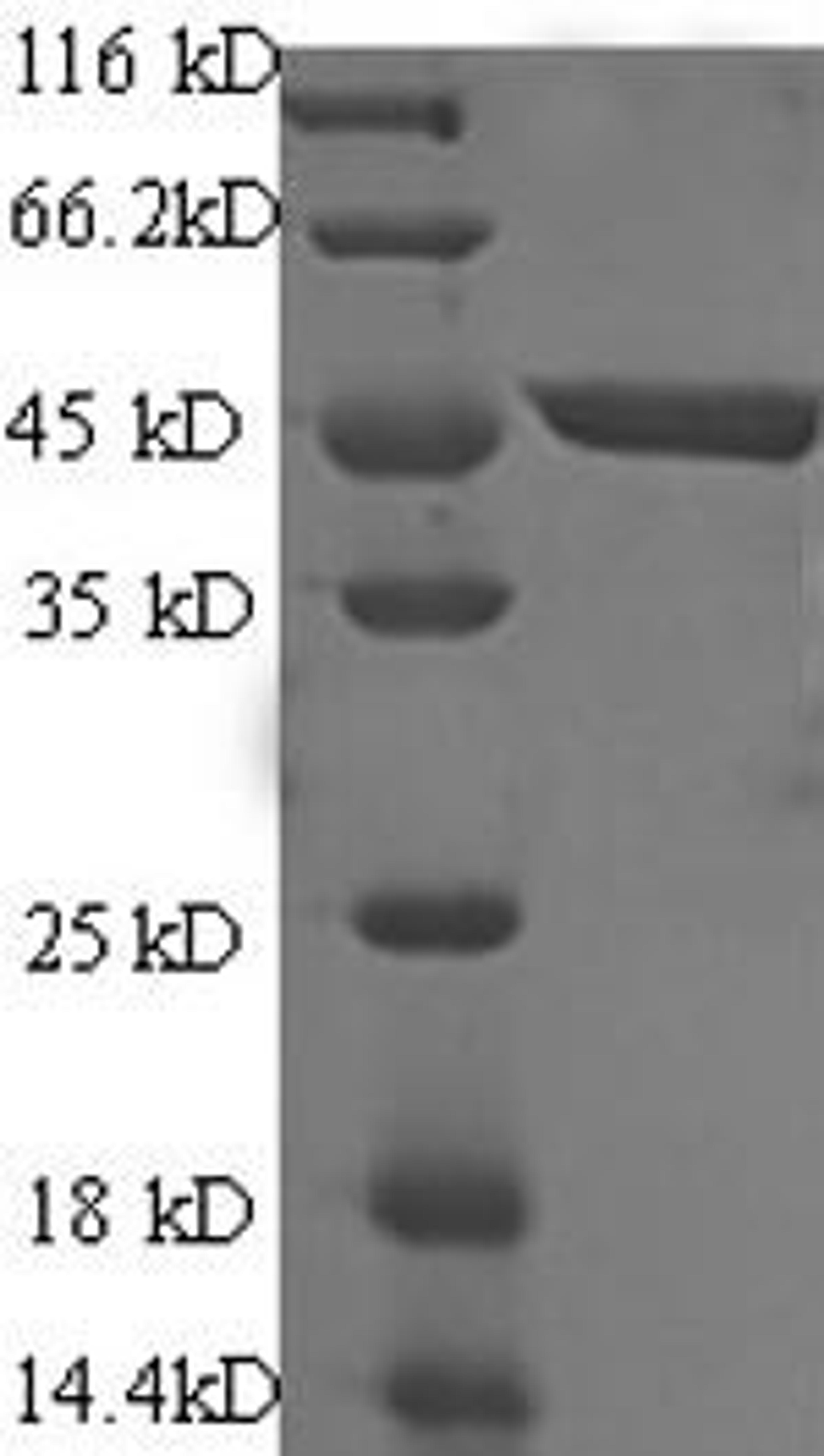 (Tris-Glycine gel) Discontinuous SDS-PAGE (reduced) with 5% enrichment gel and 15% separation gel.