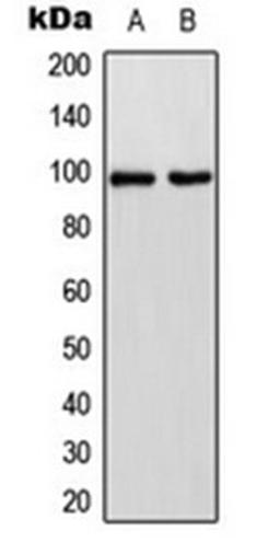 Western blot analysis of HeLa (Lane 1), HT29 (Lane 2) whole cell lysates using CDH17 antibody