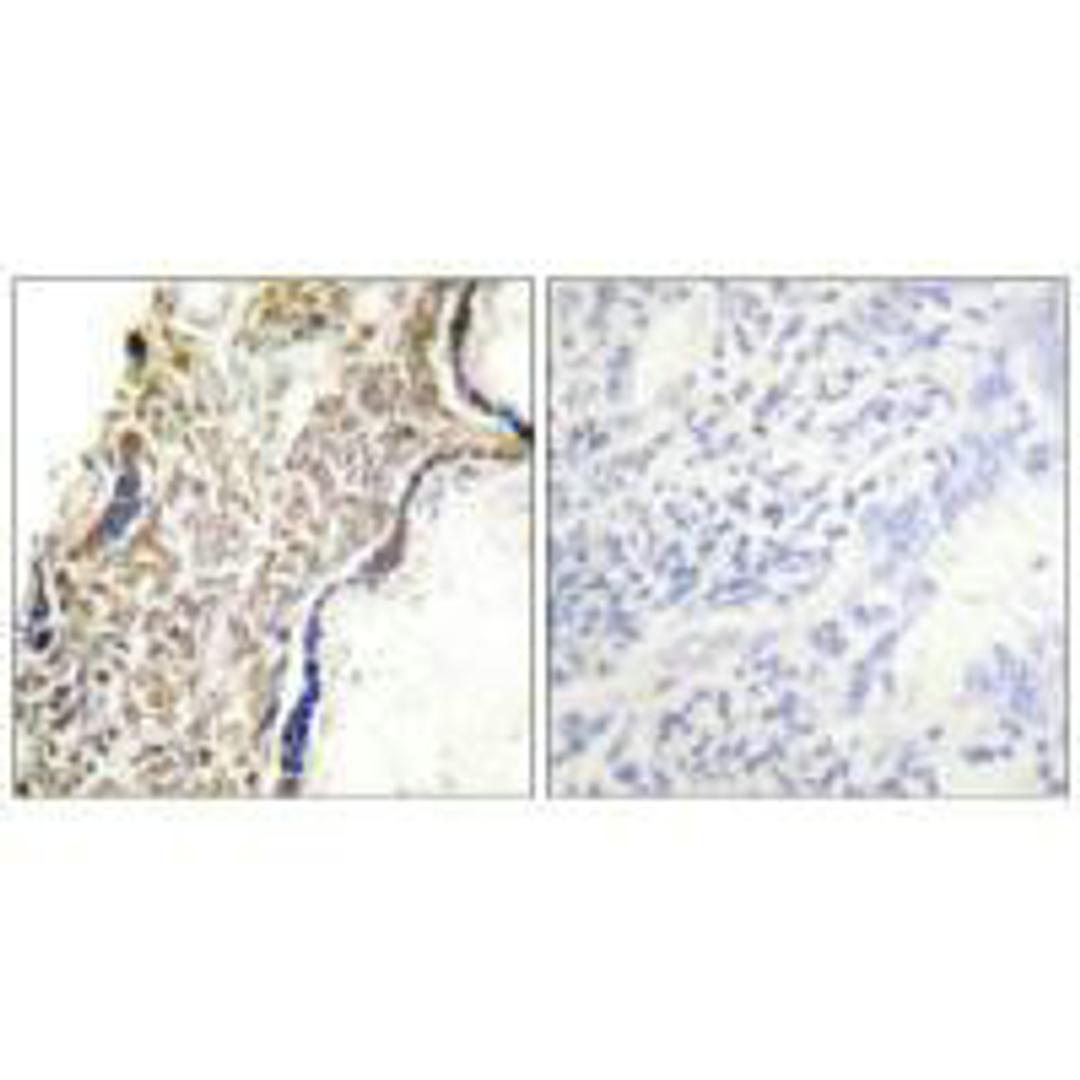 Immunohistochemical analysis of paraffin-embedded human placenta tissue using p14 ARF antibody.