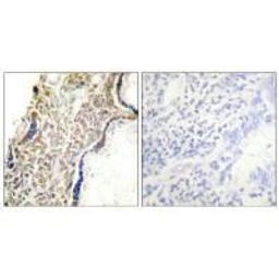 Immunohistochemical analysis of paraffin-embedded human placenta tissue using p14 ARF antibody.
