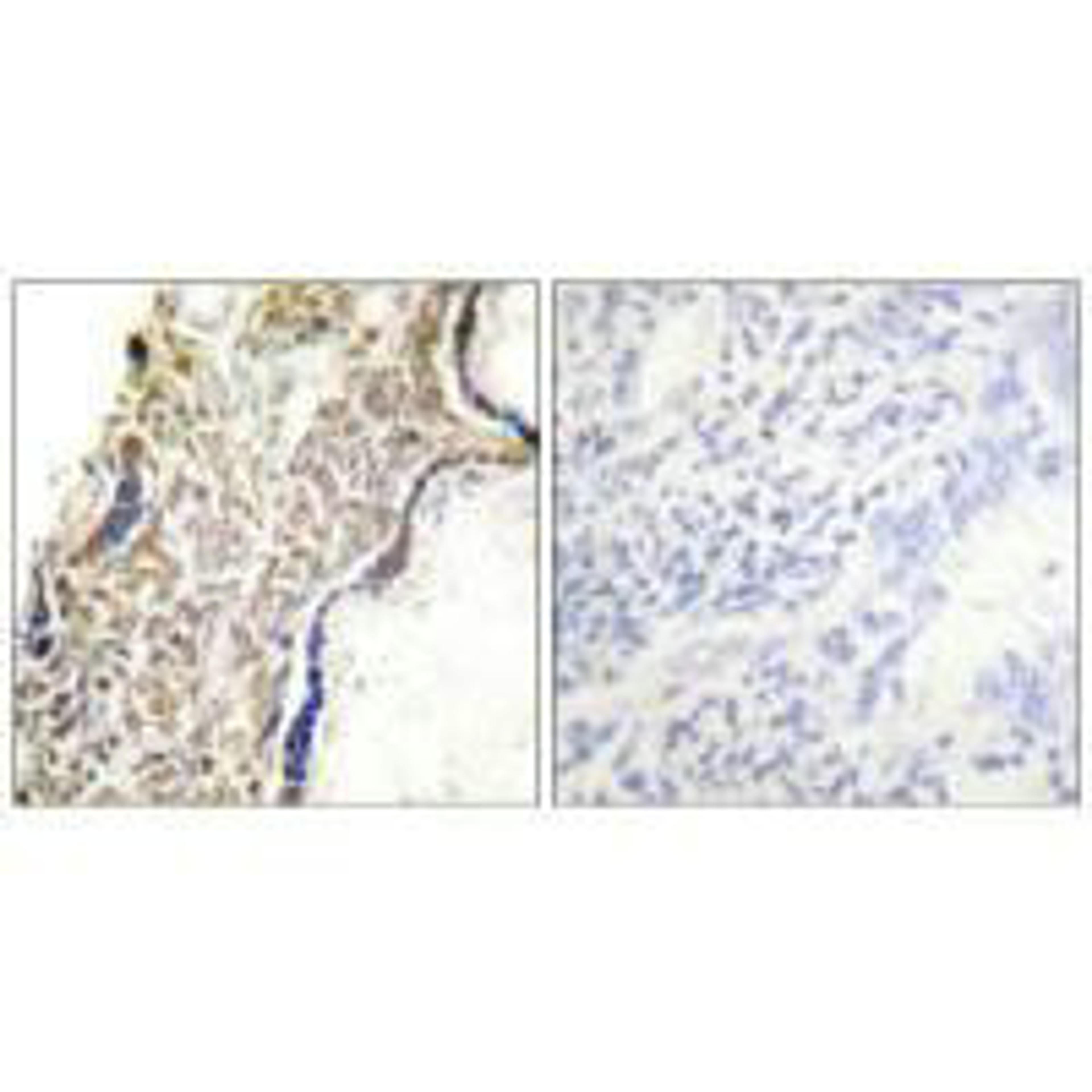 Immunohistochemical analysis of paraffin-embedded human placenta tissue using p14 ARF antibody.