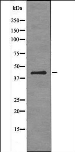 Western blot analysis of PMA treated 293 whole cell lysates using ATF-4 -Phospho-Ser224- antibody