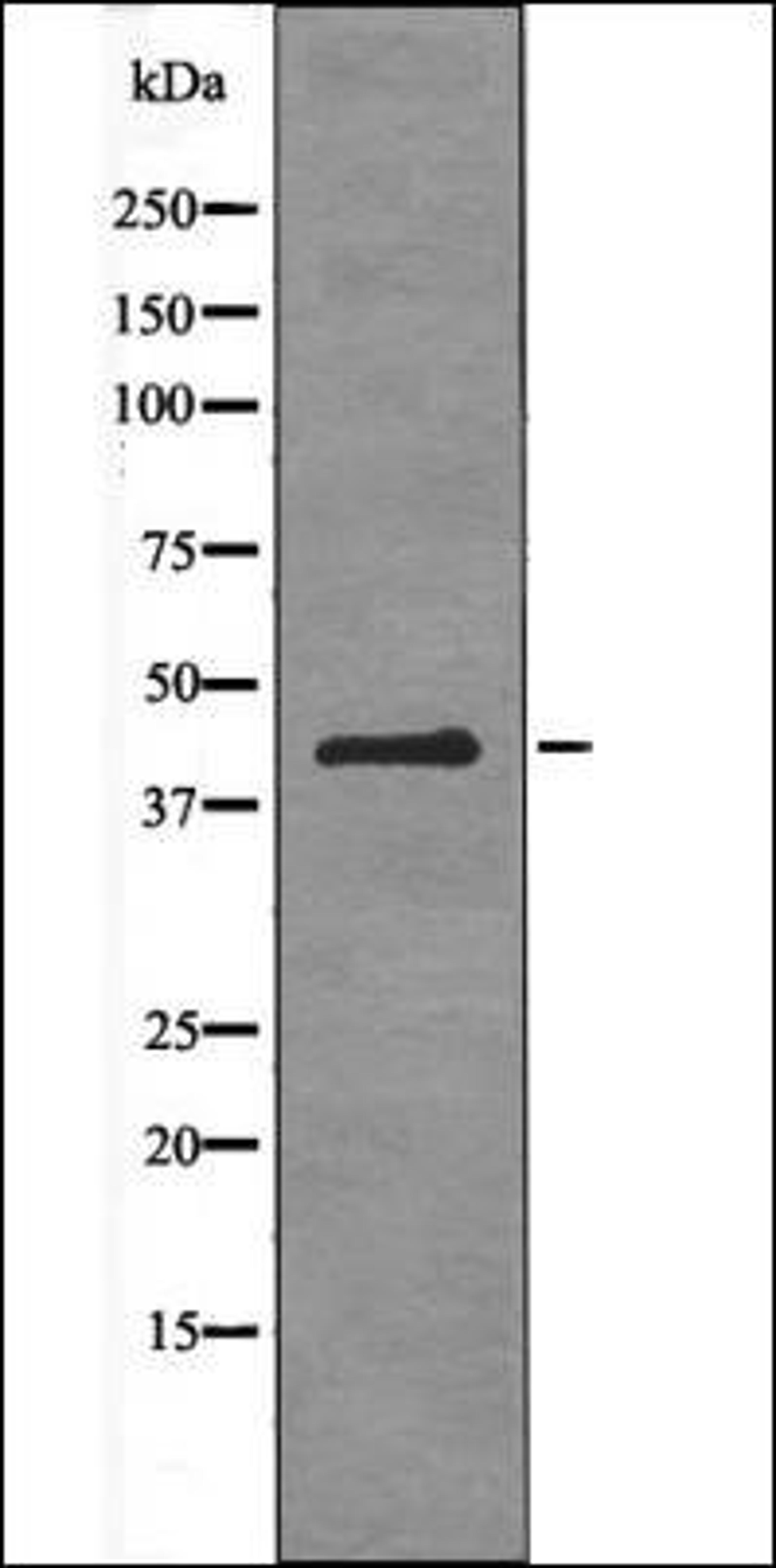 Western blot analysis of PMA treated 293 whole cell lysates using ATF-4 -Phospho-Ser224- antibody