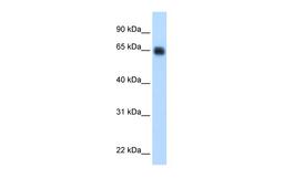 Antibody used in WB on Human Liver at 0.2-1 ug/ml.