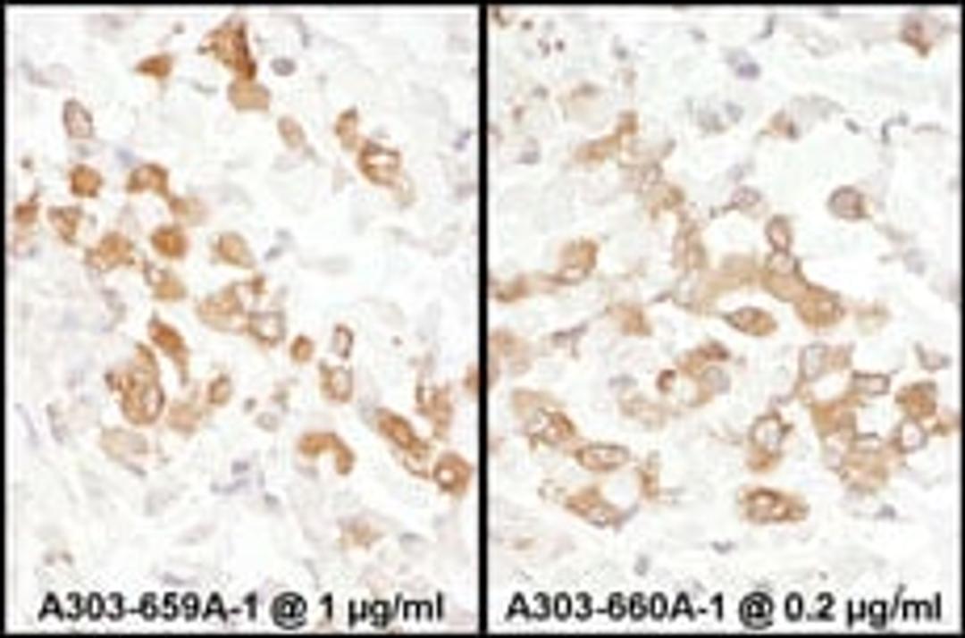 Detection of human PKM2 by immunohistochemistry.