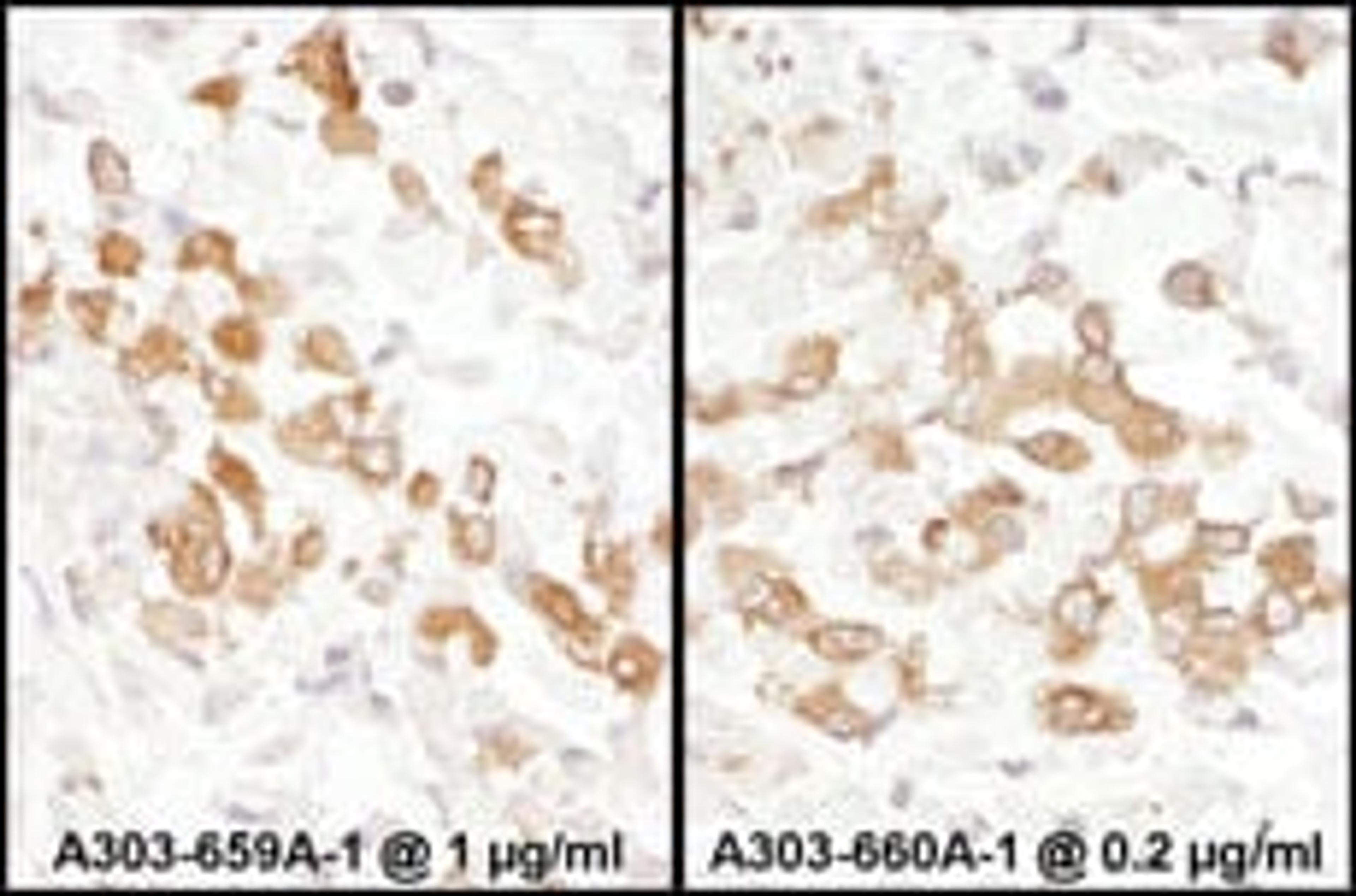 Detection of human PKM2 by immunohistochemistry.