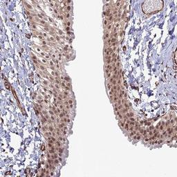 Immunohistochemistry-Paraffin: PA1 Antibody [NBP1-89792] - Staining of human urinary bladder shows moderate nuclear and cytoplasmic positivity in urothelium.