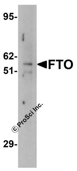 Western blot analysis of FTO in human uterus tissue lysate with FTO antibody at (A) 1 and (B) 2 μg/mL.