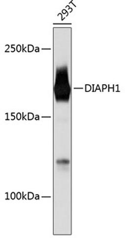 Western blot - DIAPH1 Rabbit mAb (A11596)