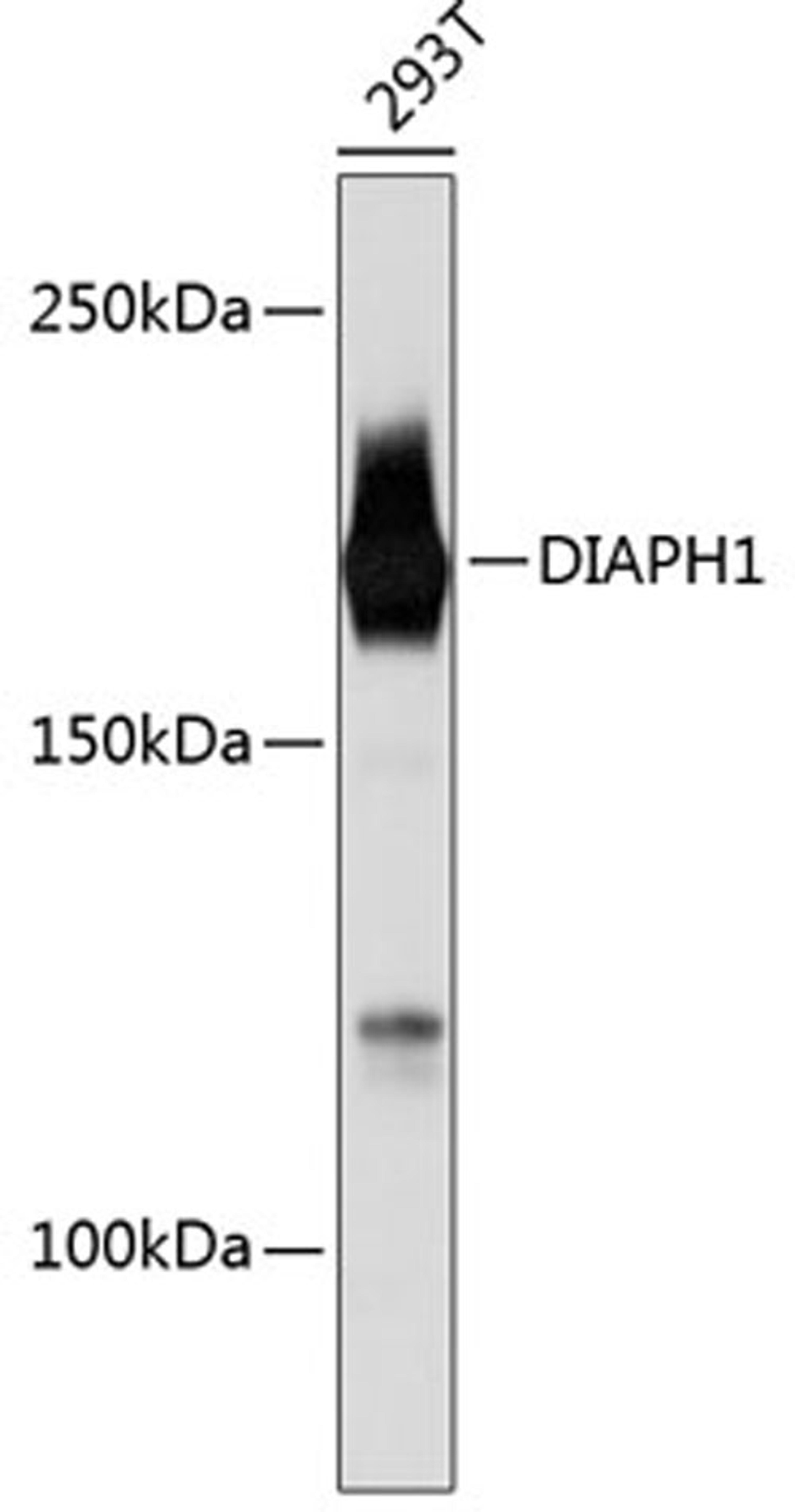 Western blot - DIAPH1 Rabbit mAb (A11596)