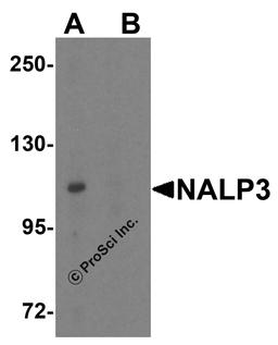 Western blot analysis of NALP3 in K562 cell lysate with NALP3 antibody at 1 μg/mL (A) in the absence and (B) in the presence of blocking peptide.