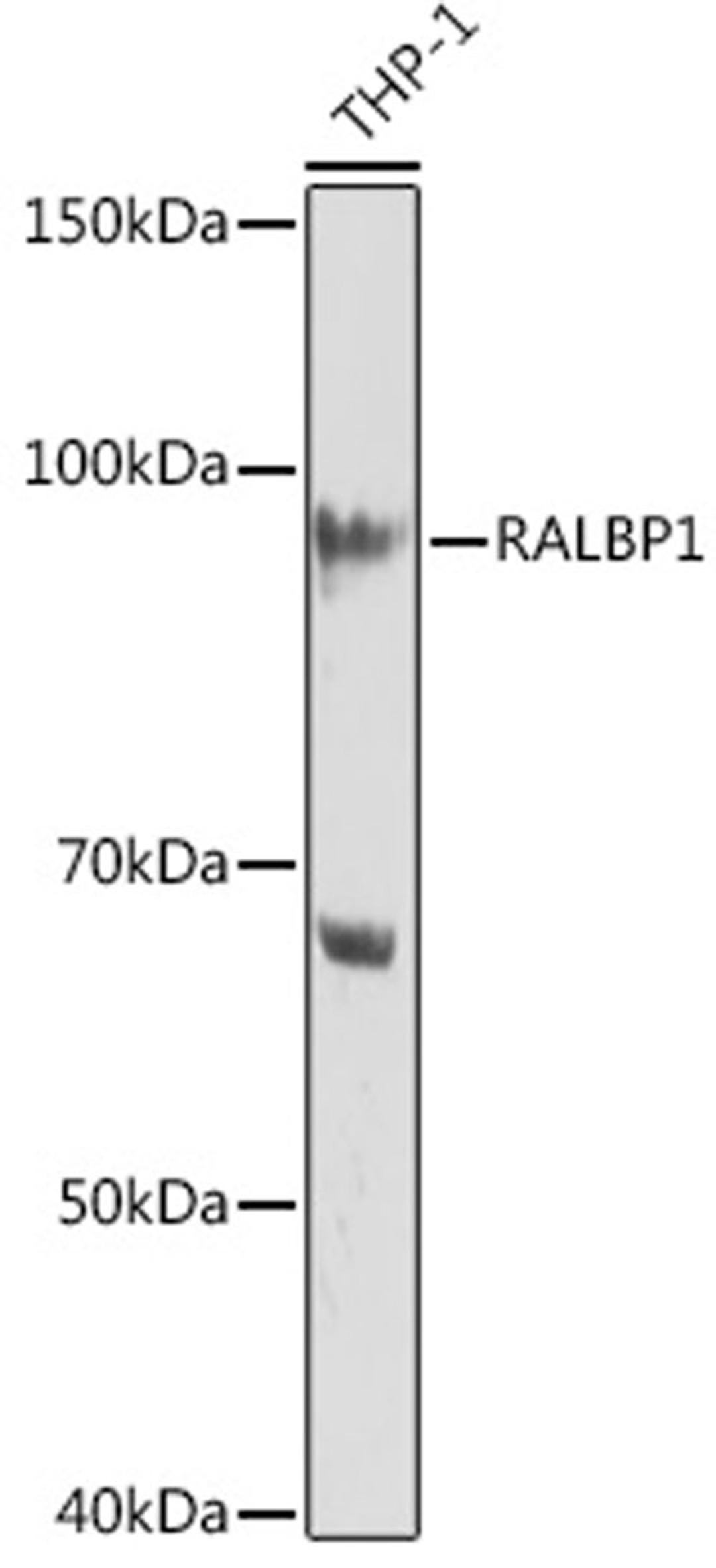 Western blot - RALBP1 Rabbit mAb (A9701)