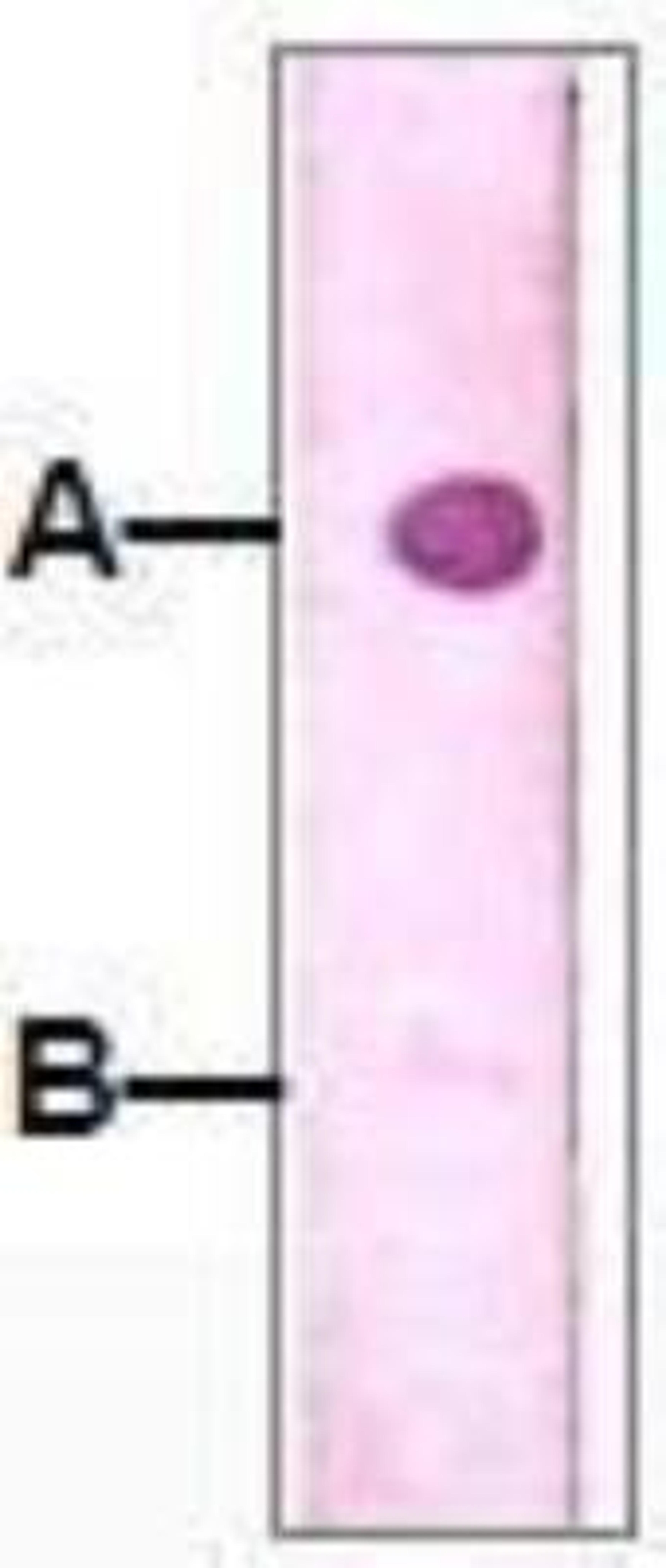 Dot Blot: IRAK4 [p Thr345] Antibody (A8A8) [NBP1-72255] -  1 mg peptide was blot onto NC membrane A: IRAK-4(pT345) B: IRAK-4(non phosphorylated) Followed by Mouse anti IRAK-4 (pT345) incubation at a 1:1000 dilution.