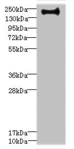 Western blot. All lanes: VSX1 antibody IgG at 0.87ug/ml + Hela whole cell lysate. Secondary. Goat polyclonal to rabbit IgG at 1/10000 dilution. Predicted band size: 159, 154, 153, 152, 151, 147, 160 kDa. Observed band size: 159 kDa. 