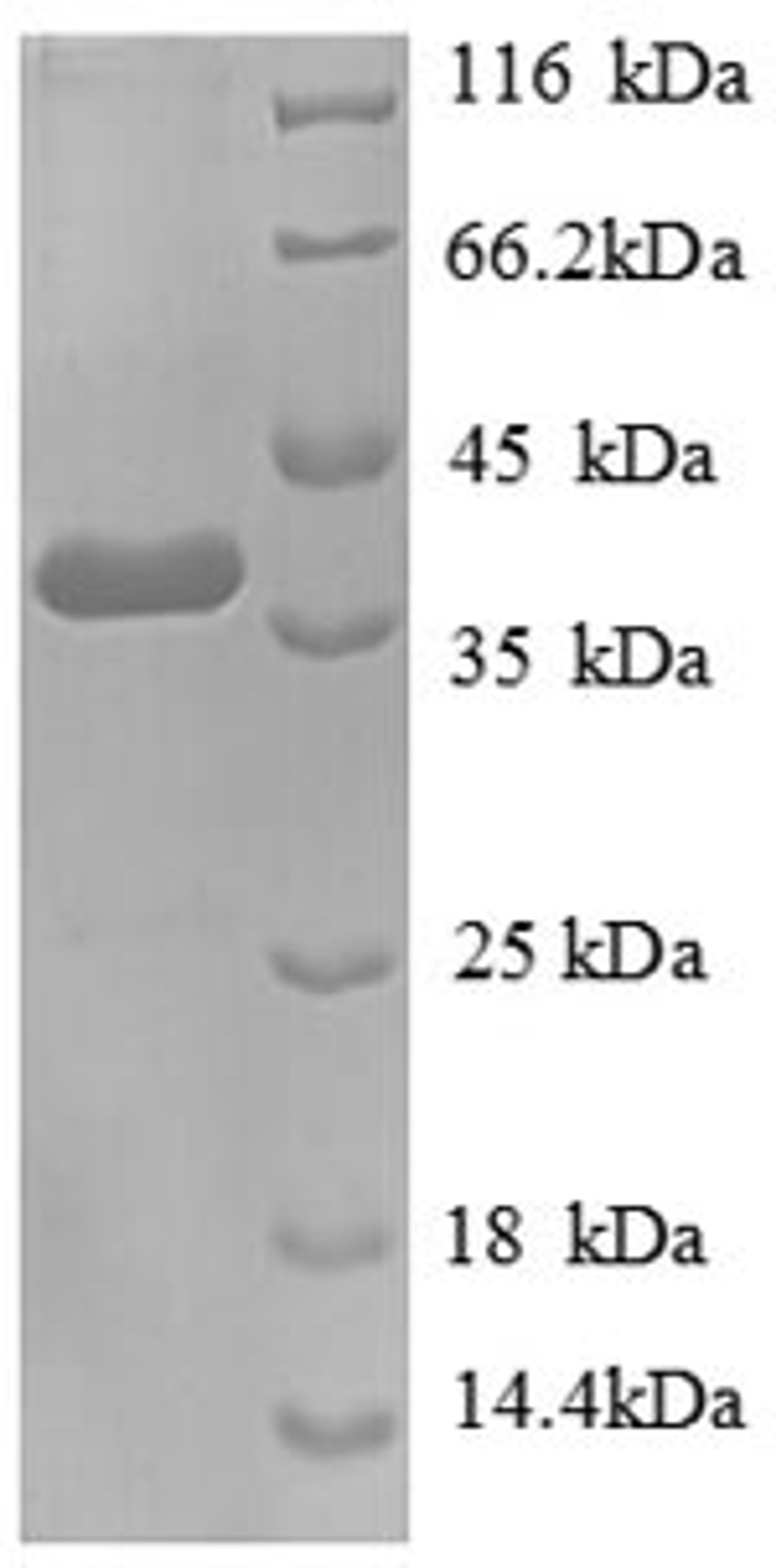 (Tris-Glycine gel) Discontinuous SDS-PAGE (reduced) with 5% enrichment gel and 15% separation gel.