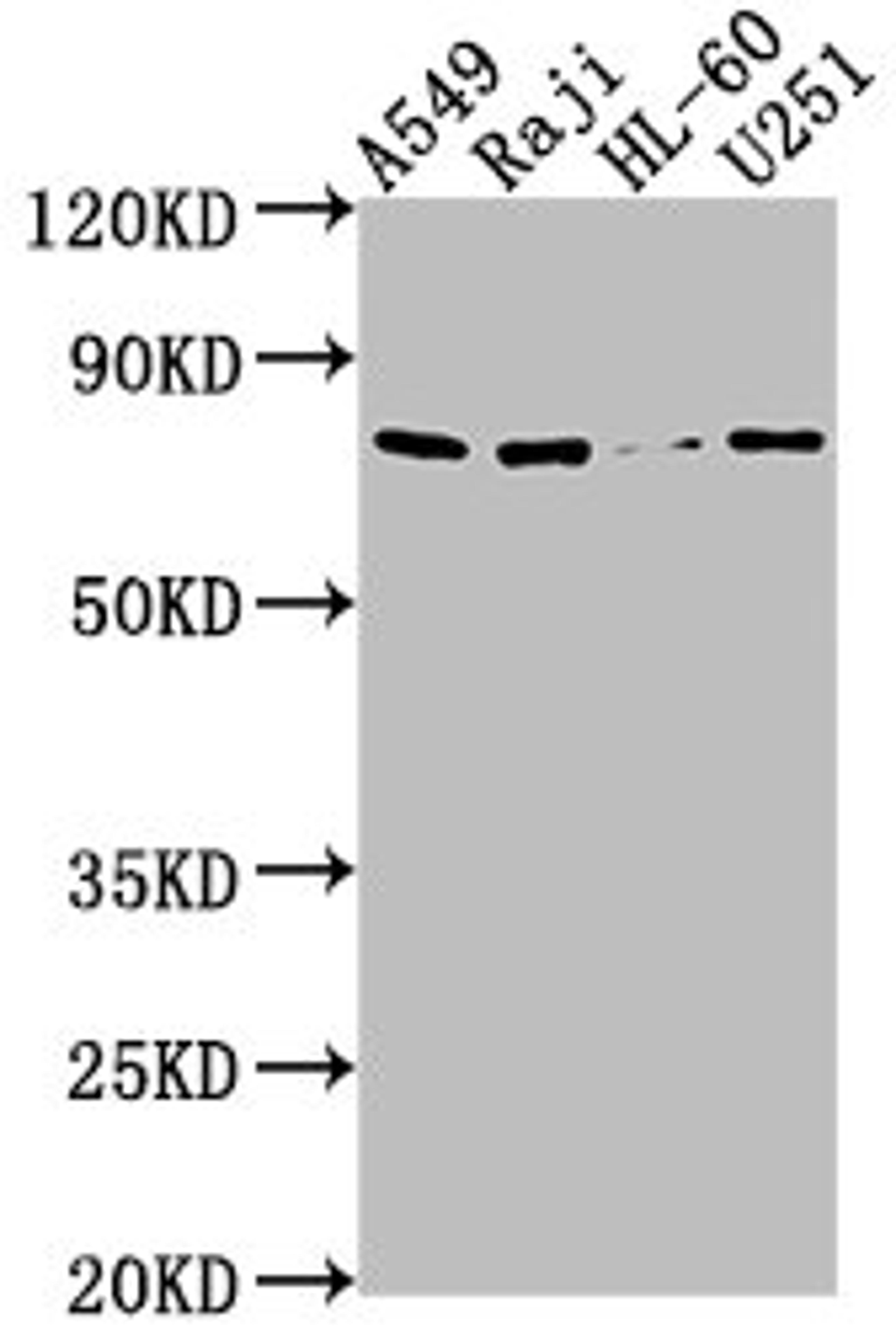Western Blot. Positive WB detected in: A549 whole cell lysate, Raji whole cell lysate, HL60 whole cell lysate, U251 whole cell lysate. All lanes: RANBP9 antibody at 1:1000. Secondary. Goat polyclonal to rabbit IgG at 1/50000 dilution. Predicted band size: 78, 44, 56 kDa. Observed band size: 78 kDa