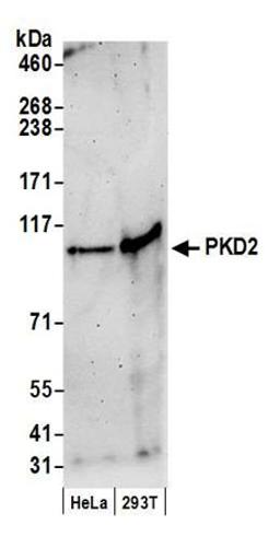 Detection of human PKD2 by western blot.