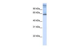 Antibody used in WB on Human 721_B at 0.2-1 ug/ml.