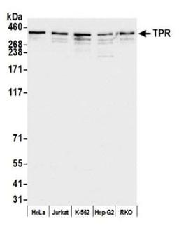 Detection of human TPR by western blot.