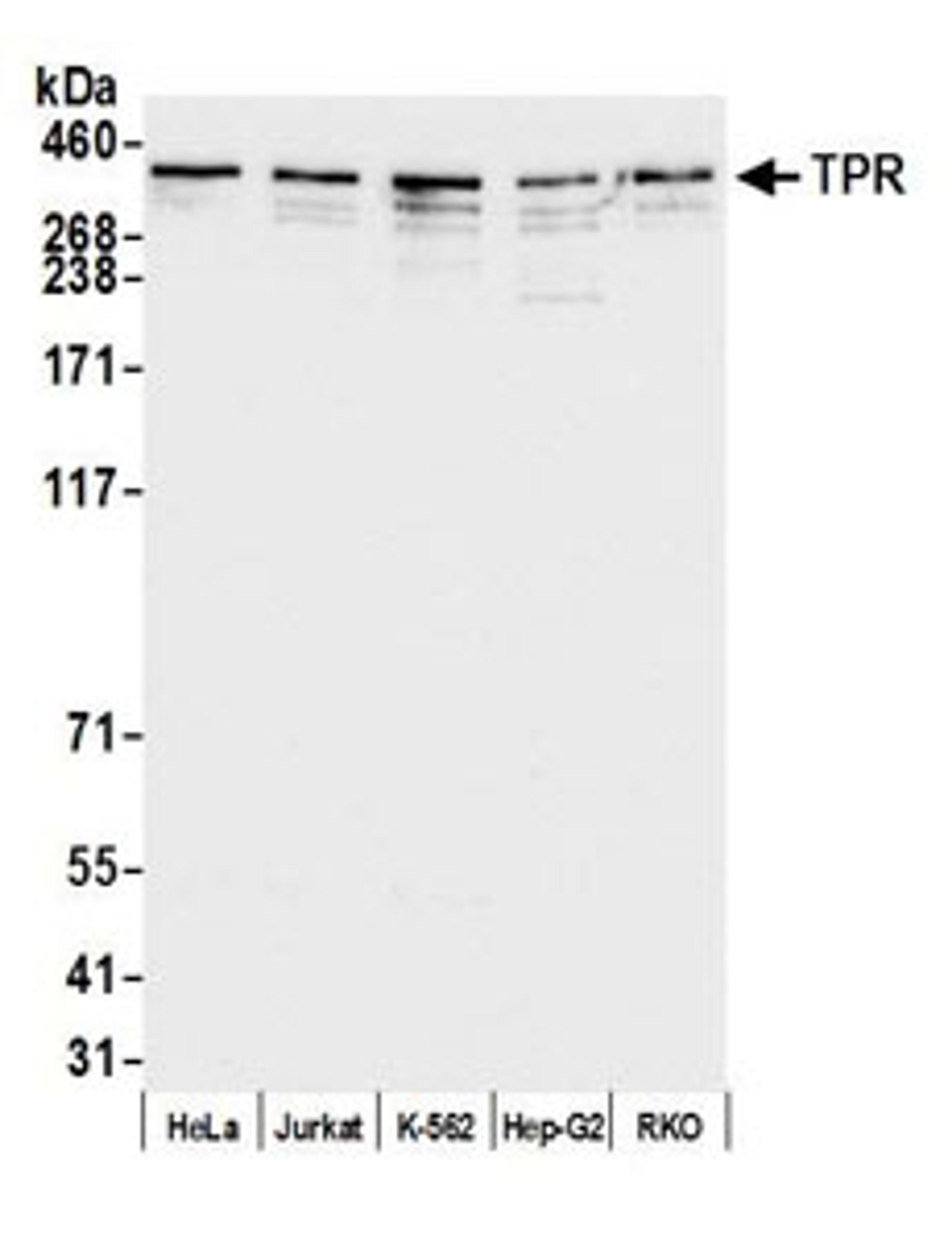 Detection of human TPR by western blot.