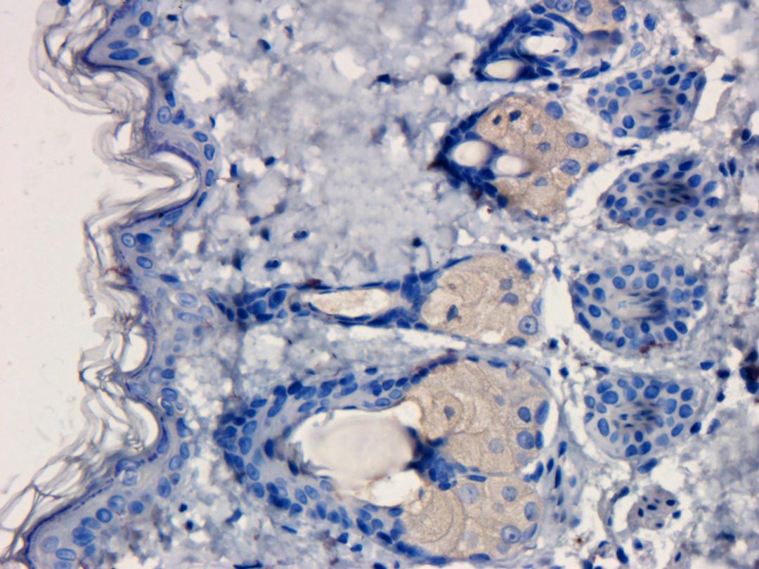 Immunohistochemical staining of rat skin tissue using anti-Mast Cell Chymase (dilution of primary antibody - 1:100)