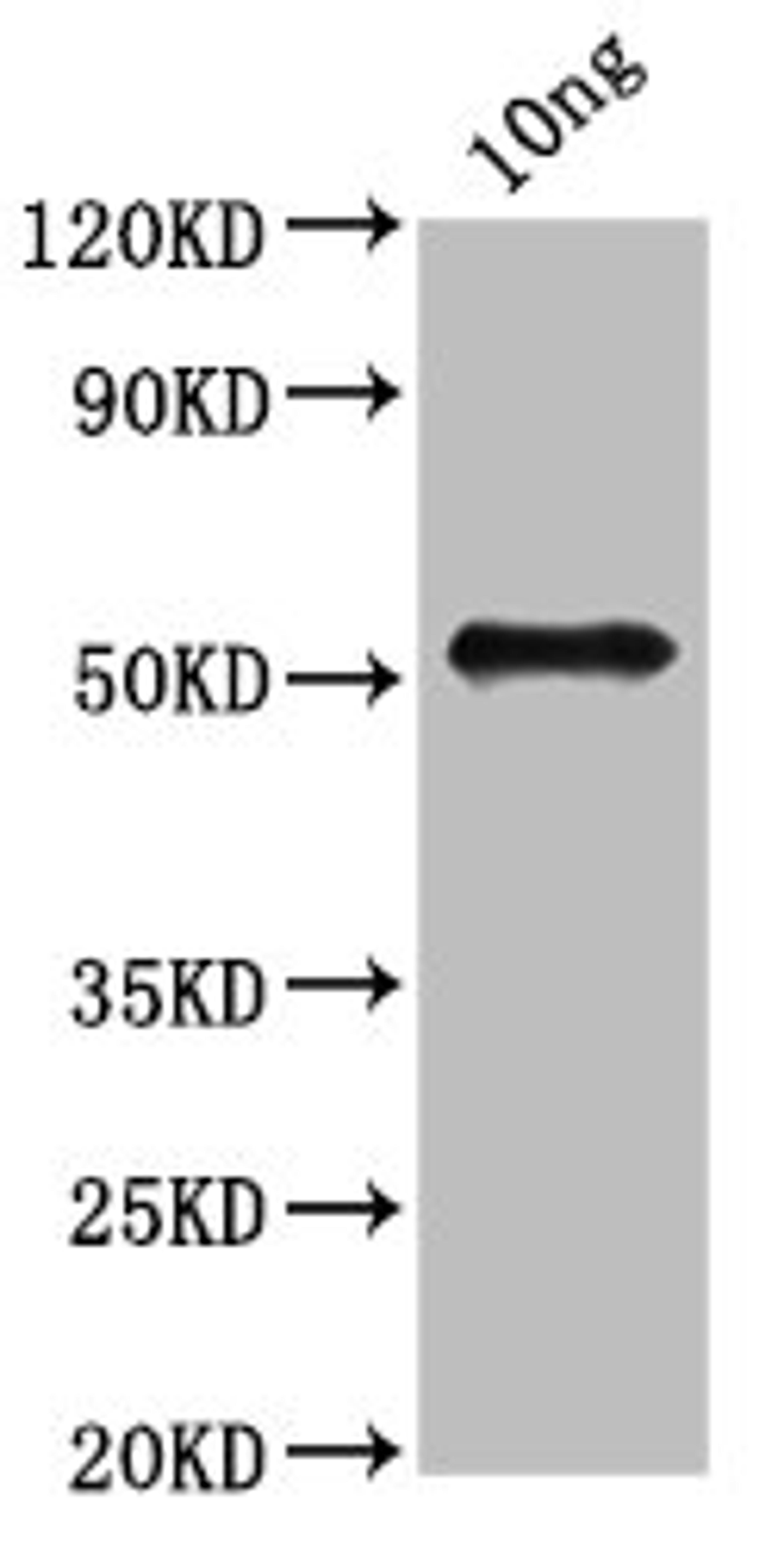 Western Blot. Positive WB detected in Recombinant protein. All lanes: fbpB antibody at 3.2ug/ml. Secondary. Goat polyclonal to rabbit IgG at 1/50000 dilution. Predicted band size: 50 kDa. Observed band size: 50 kDa. 