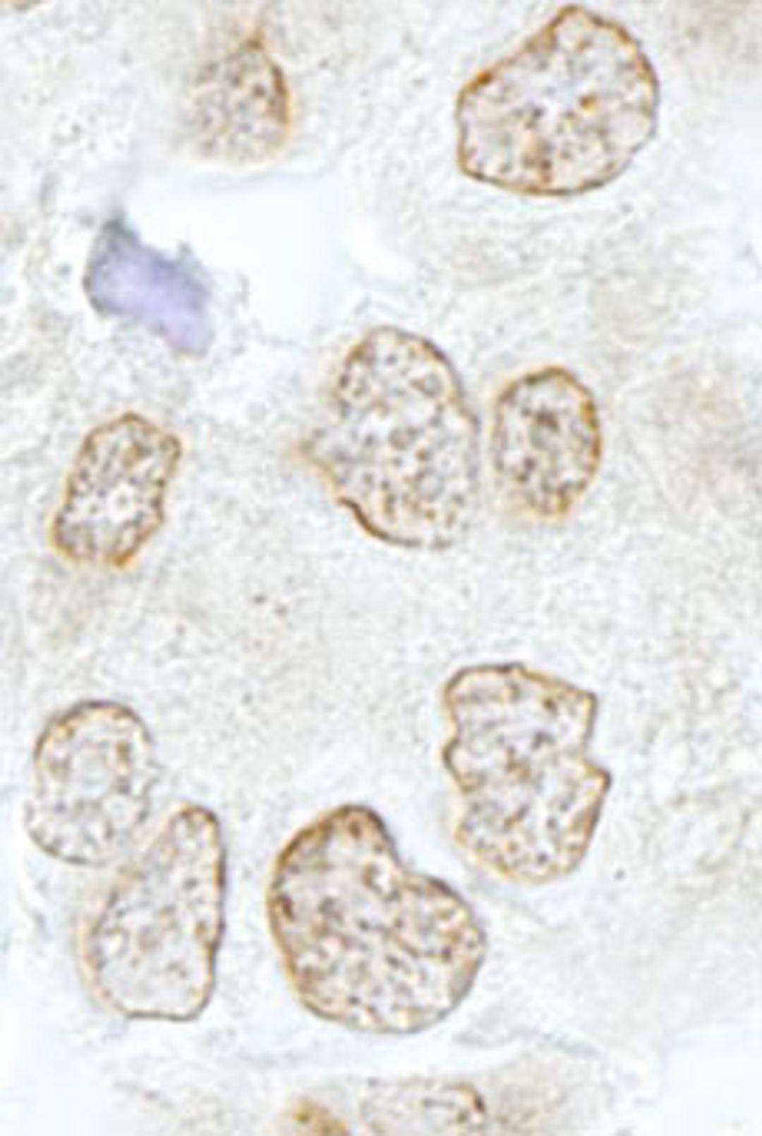 Detection of human SSB1 by immunohistochemistry.