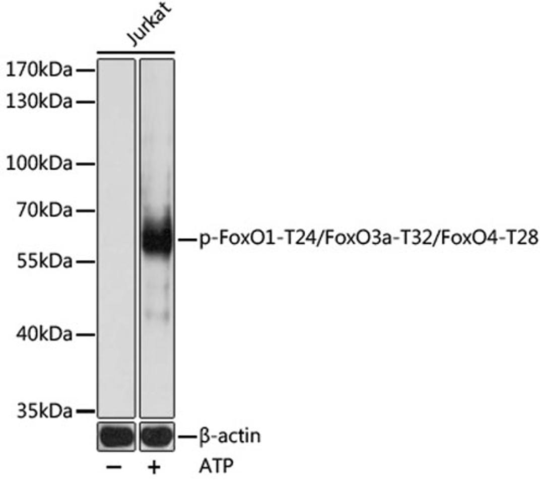 Western blot - Phospho-FoxO1-T24/FoxO3a-T32/FoxO4-T28 pAb (AP0892)