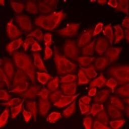 Immunofluorescent analysis of A549 cells using PRKD3 antibody