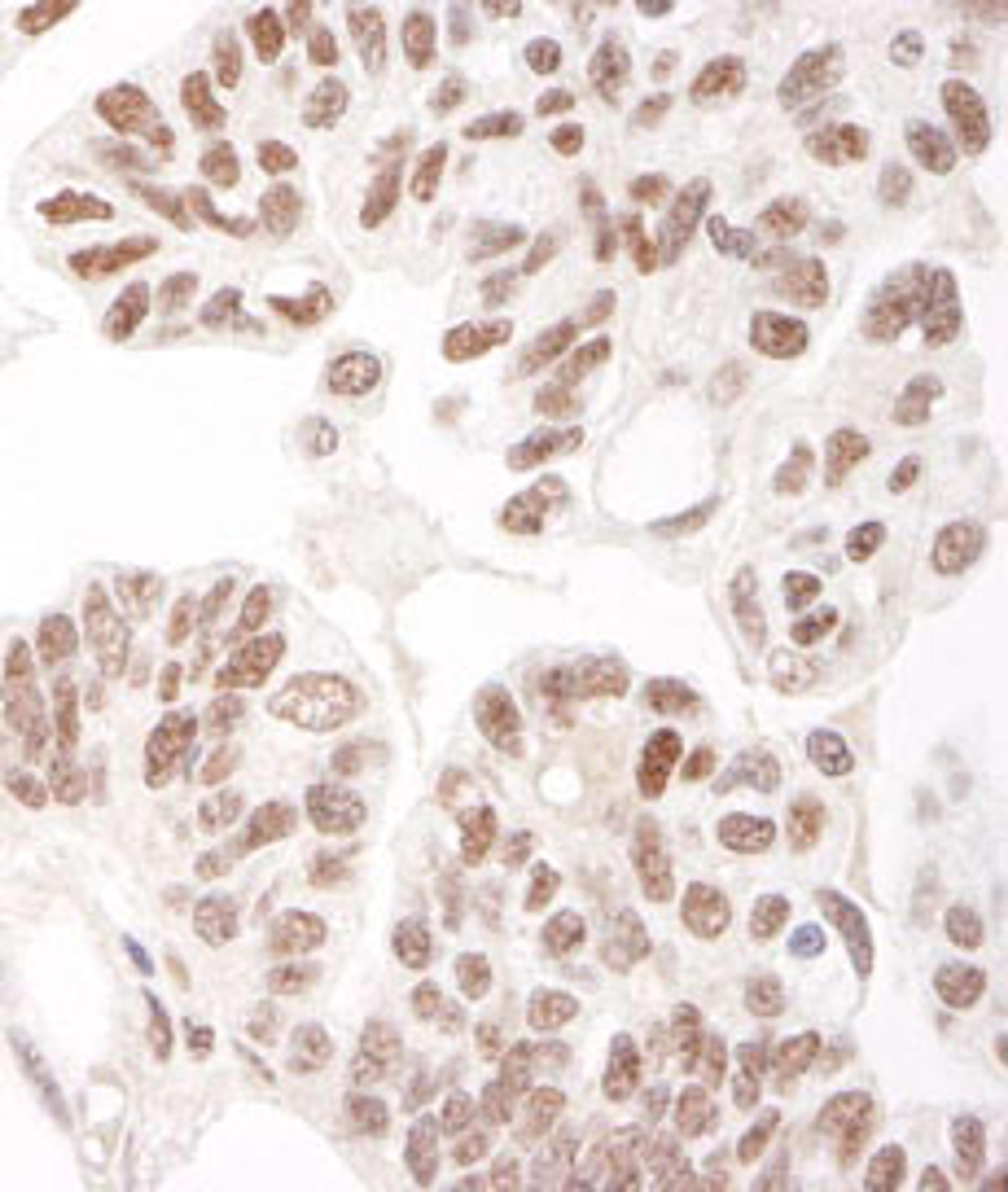 Detection of human HDAC2 by immunohistochemistry.