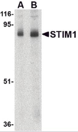 Western blot analysis of STIM1 in mouse thymus tissue lysate with STIM1 antibody at (A) 1 and (B) 2 &#956;g/mL.