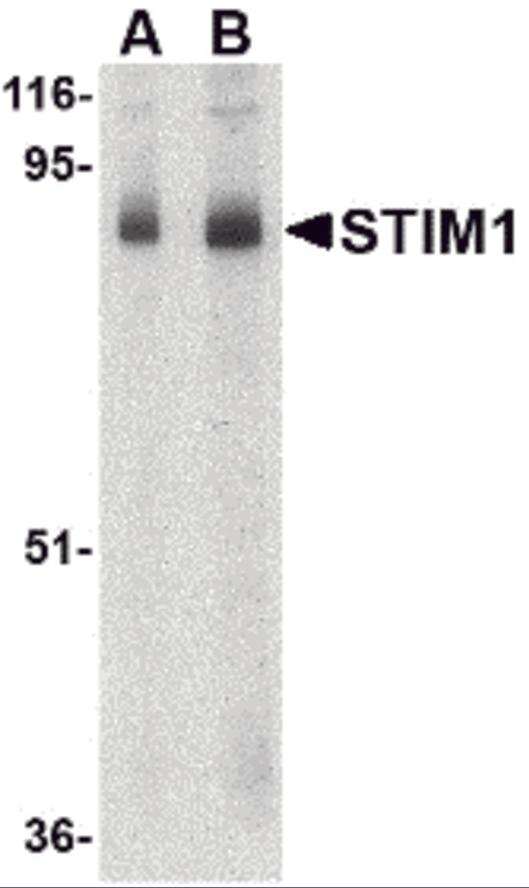 Western blot analysis of STIM1 in mouse thymus tissue lysate with STIM1 antibody at (A) 1 and (B) 2 μg/mL.