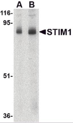 Western blot analysis of STIM1 in mouse thymus tissue lysate with STIM1 antibody at (A) 1 and (B) 2 μg/mL.