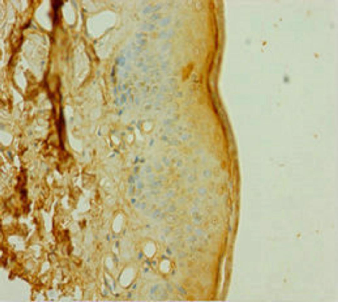 Immunohistochemistry of paraffin-embedded human skin tissue using CSB-PA858723HA01HU at dilution of 1:100