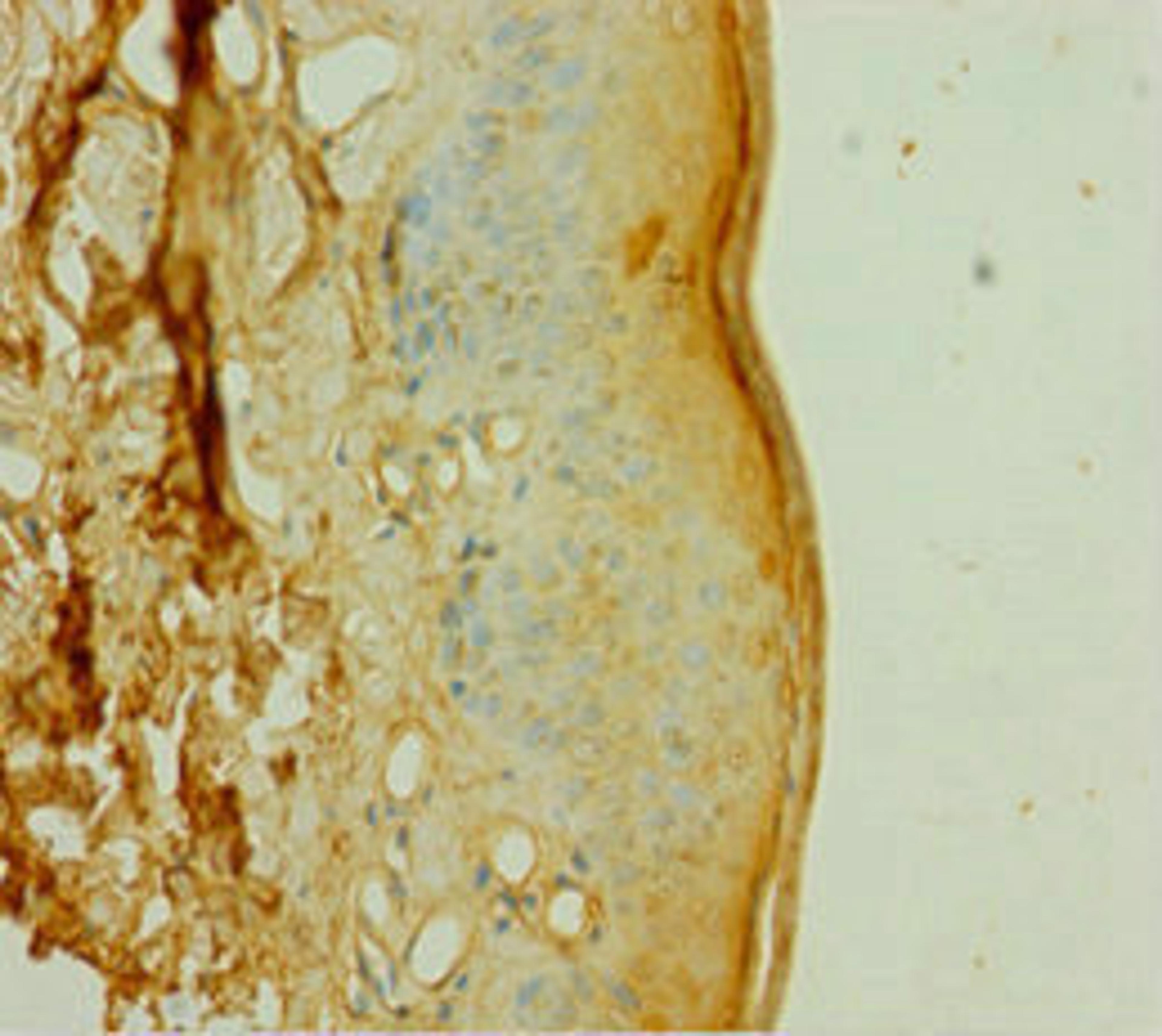 Immunohistochemistry of paraffin-embedded human skin tissue using CSB-PA858723HA01HU at dilution of 1:100
