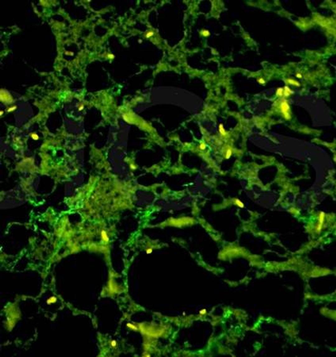 Immunofluorescence analysis of rat spinal cord tissue using Neurofilament H antibody 