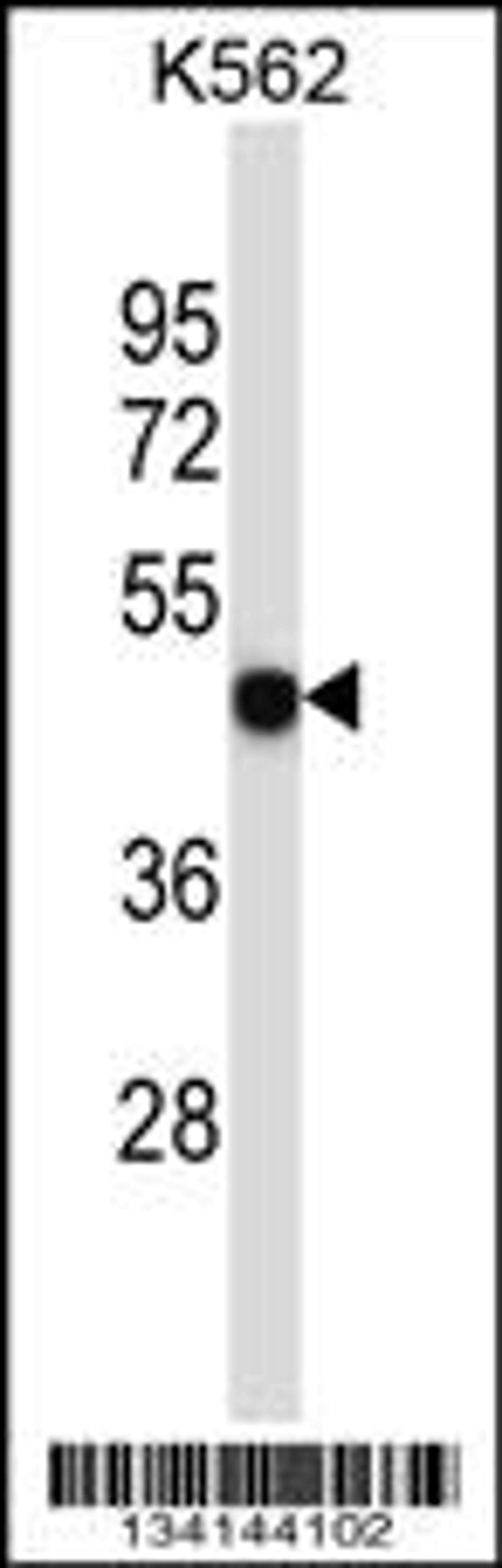 Western blot analysis in K562 cell line lysates (35ug/lane).